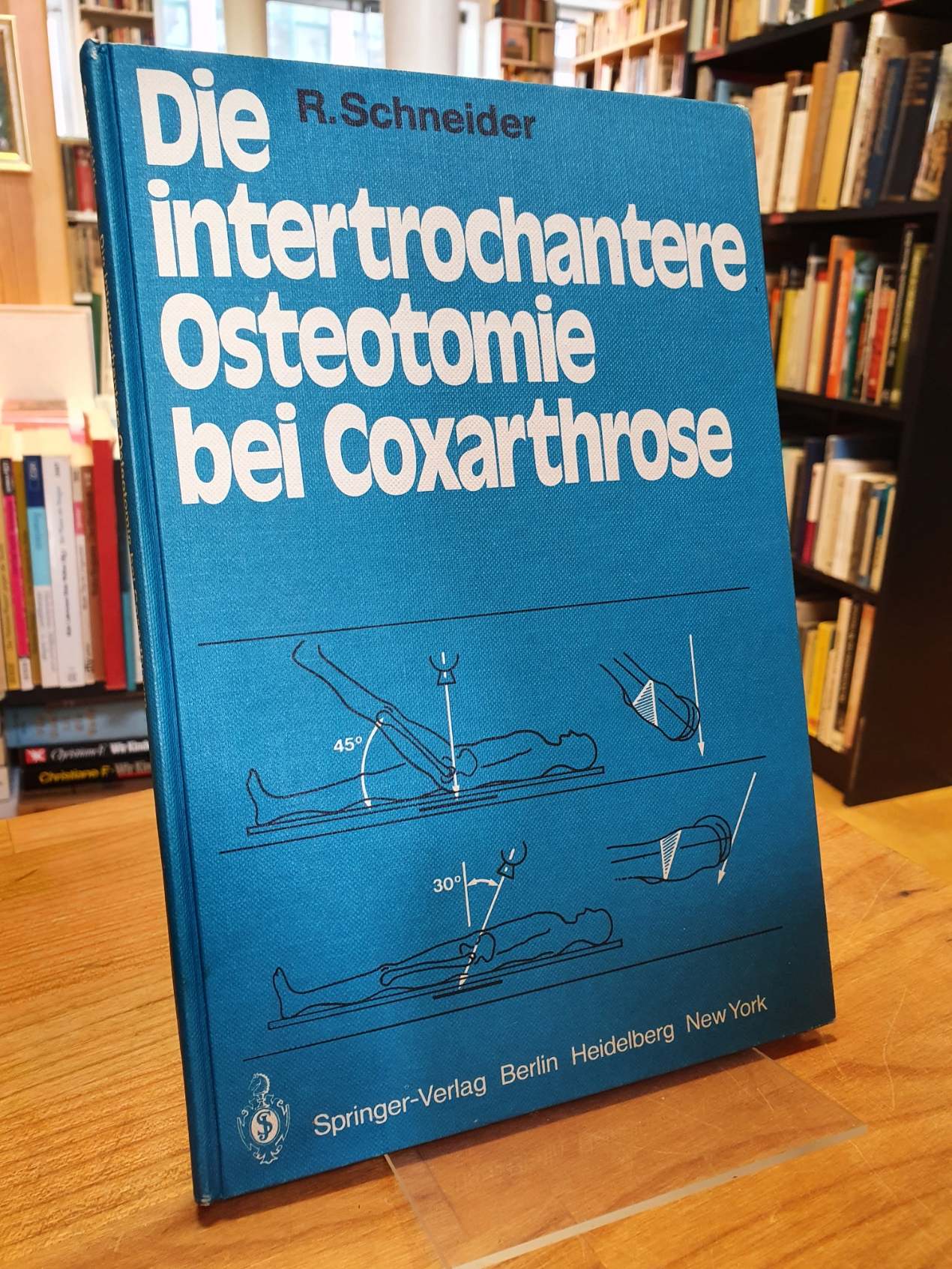 Schneider, Die intertrochantere Osteotomie bei Coxarthrose,